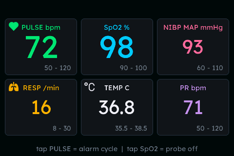 Patient Monitor (alarm ladder + probe-off)